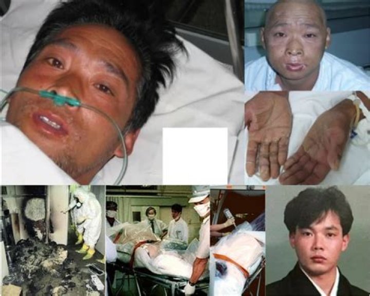 The Enduring Legacy Of Hisashi Ouchi's 83-Day Ordeal