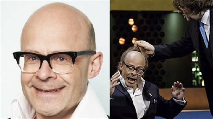 Top Bald Comedian Actors You Need To Know