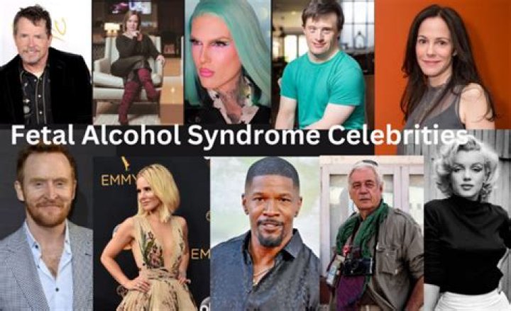 The Surprising Truth About Fetal Alcohol Syndrome And Celebrities
