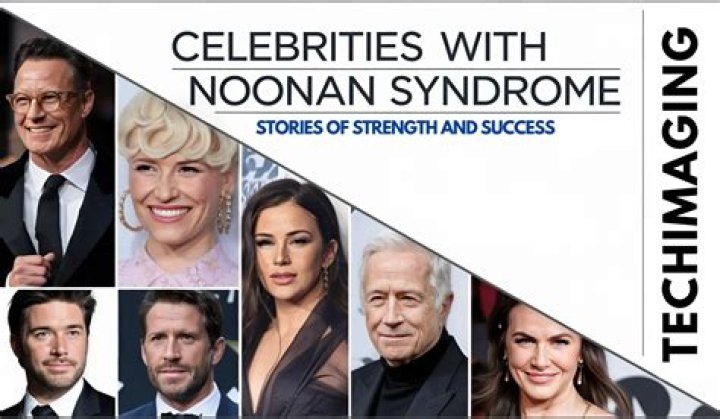 Unveiling The Faces Of Noonan Syndrome: Celebrities With The Rare Genetic Disorder