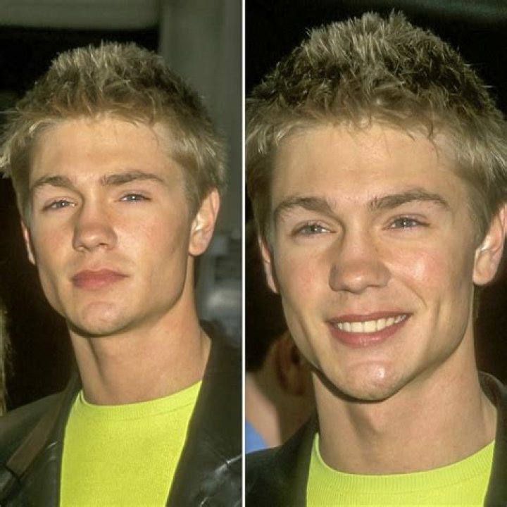 Unveiling The Secrets Of Chad Michael Murray's Nose: Uncovering The Truth