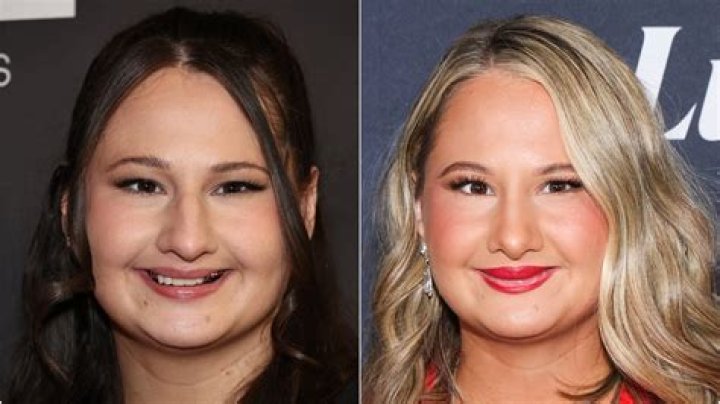 Gypsy Rose's Nose Job: Everything You Need To Know