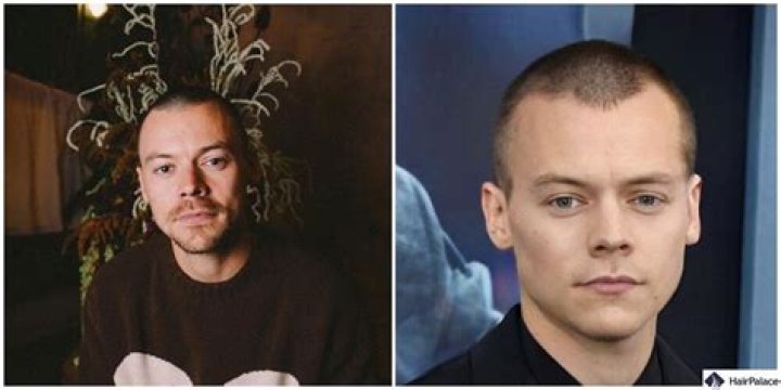 Unbelievable! Harry Styles Goes Bold And Baldsome