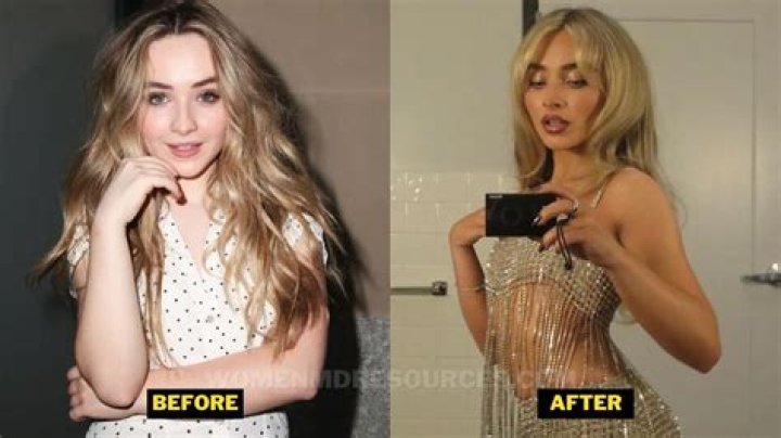 Unveiling The Truth: Has Sabrina Carpenter Gotten Plastic Surgery?
