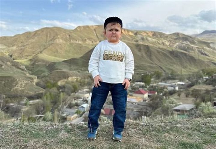 Hasbulla's Fortune: Uncovering The Net Worth Of The Russian Social Media Star