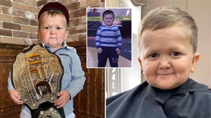 How Old Is Hasbulla? Find Out The Real Age