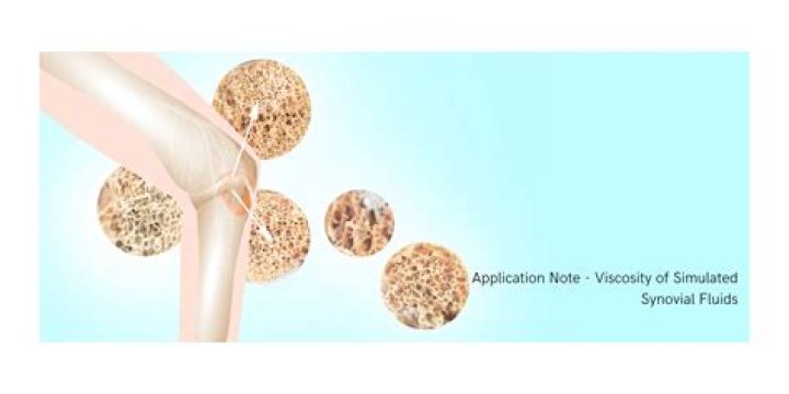 Incredible Guide To Understanding Synovial Fluid