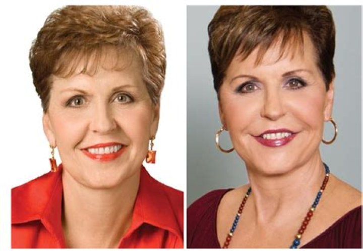 The Ultimate Guide To Joyce Meyer's Cosmetic Surgery Journey