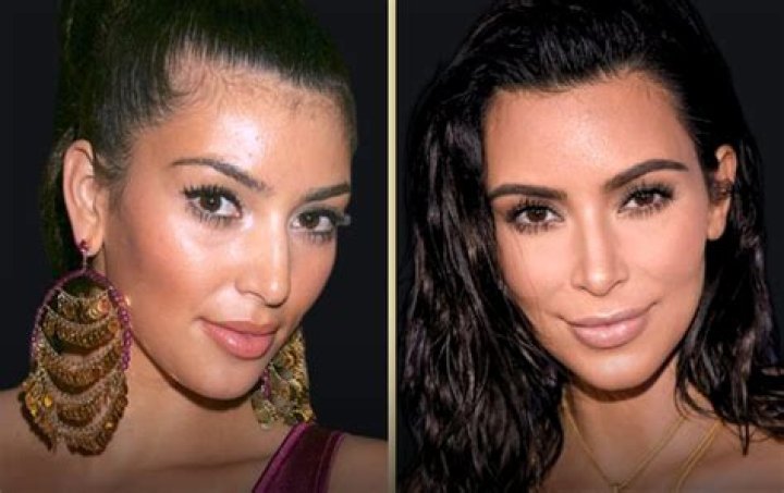 Kim Kardashian Before Surgery: The Transformation Uncovered