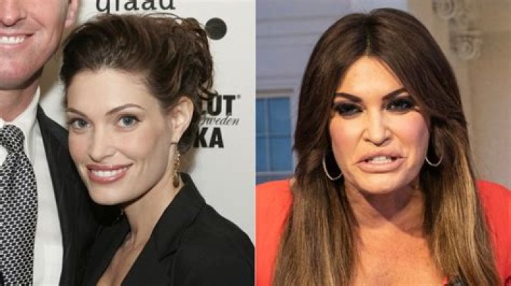Unveiling The Transformation: The Story Behind Kimberly Gilfoyle's Plastic Surgery