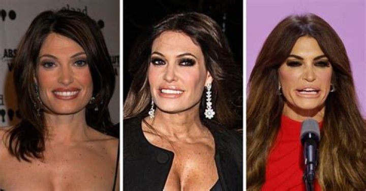 Kimberly Guilfoyle's Transformation: Before And After Photos