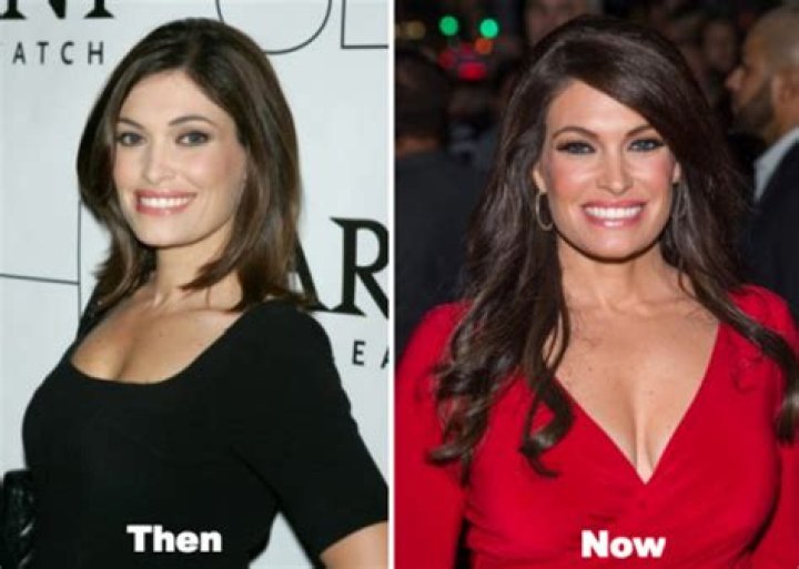 Unveiling Kimberly Guilfoyle's Plastic Surgery Transformation: Before And After Photos