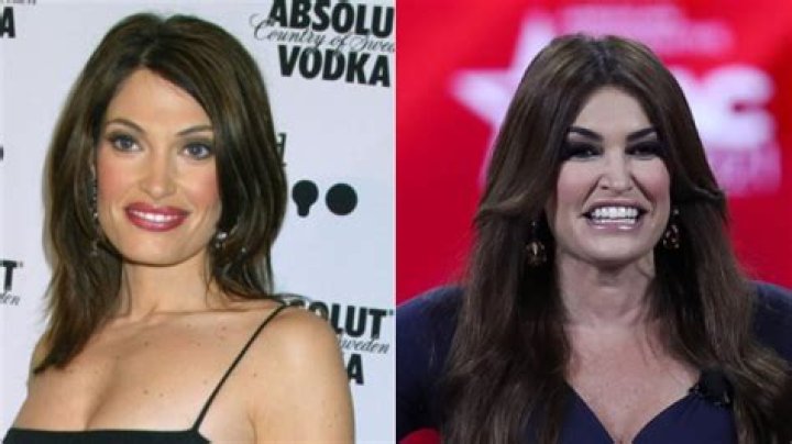 What's The Shocking Truth Behind Kimberly Guilfoyle's Changed Appearance?