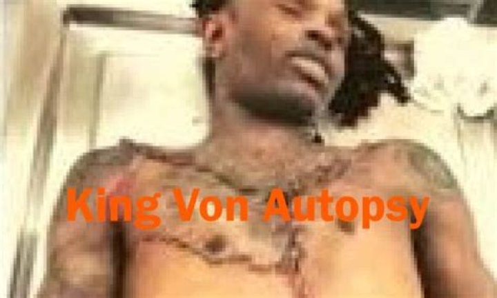 King Von Autopsy Results: A Shocking Revelation