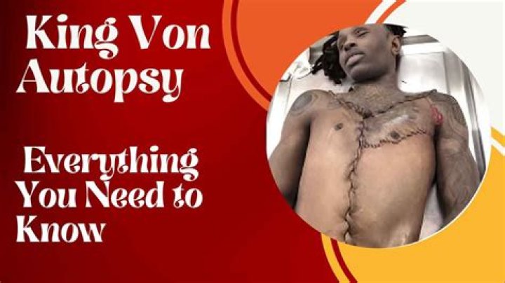 King Von's Autopsy Report: A Detailed Examination