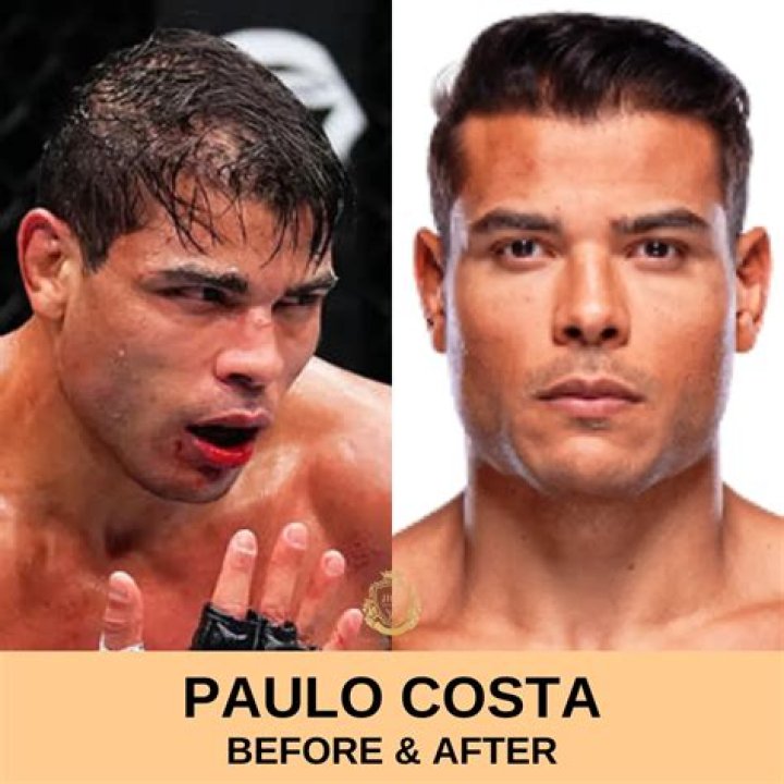 The Ultimate Guide To Finding The Perfect Paulo Costa Replacement
