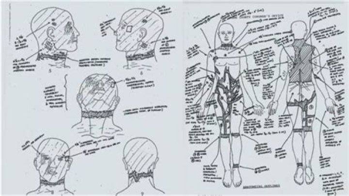 Unmasking The Enigma: A Detailed Autopsy Of Shad Thyrion