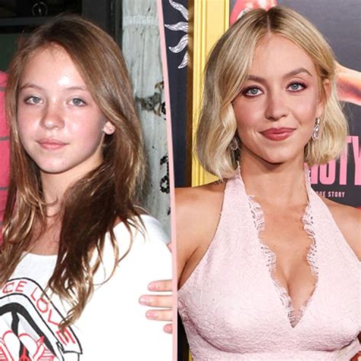 Sydney Sweeney Plastic Surgery: What You Need To Know