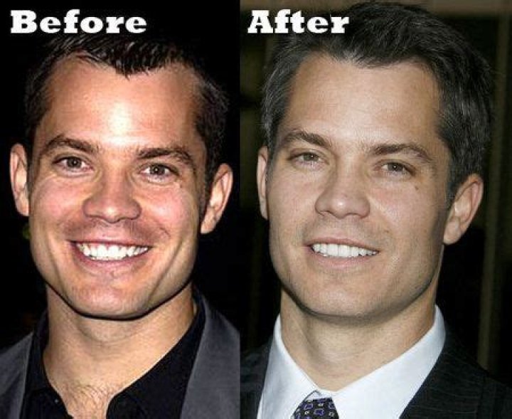 Unveiling The Charm: Timothy Olyphant's Teeth