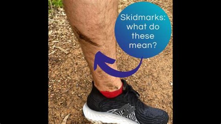 The Ultimate Guide To Understanding Skidmarks: Causes, Consequences, And Prevention