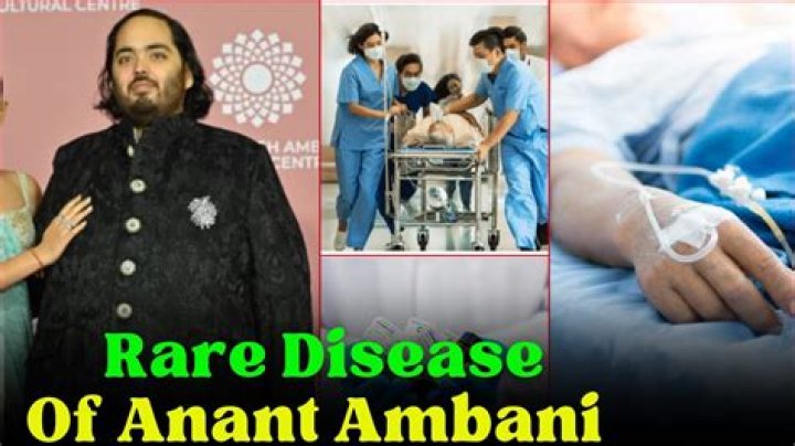 Unraveling The Health Mystery: What Disease Does Anant Ambani Have?