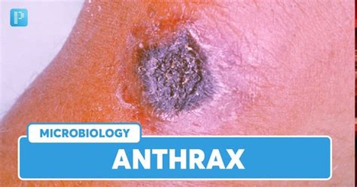 Unvealing The Enigmatic Chino Antrax: A Comprehensive Guide